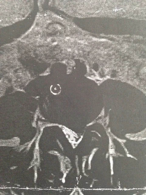 A spinal x-ray before spinal decompression